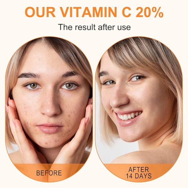 Premium 20% Vitamin C Serum For Face with Hyaluronic Acid, Retinol & Amino Acids - Image 5